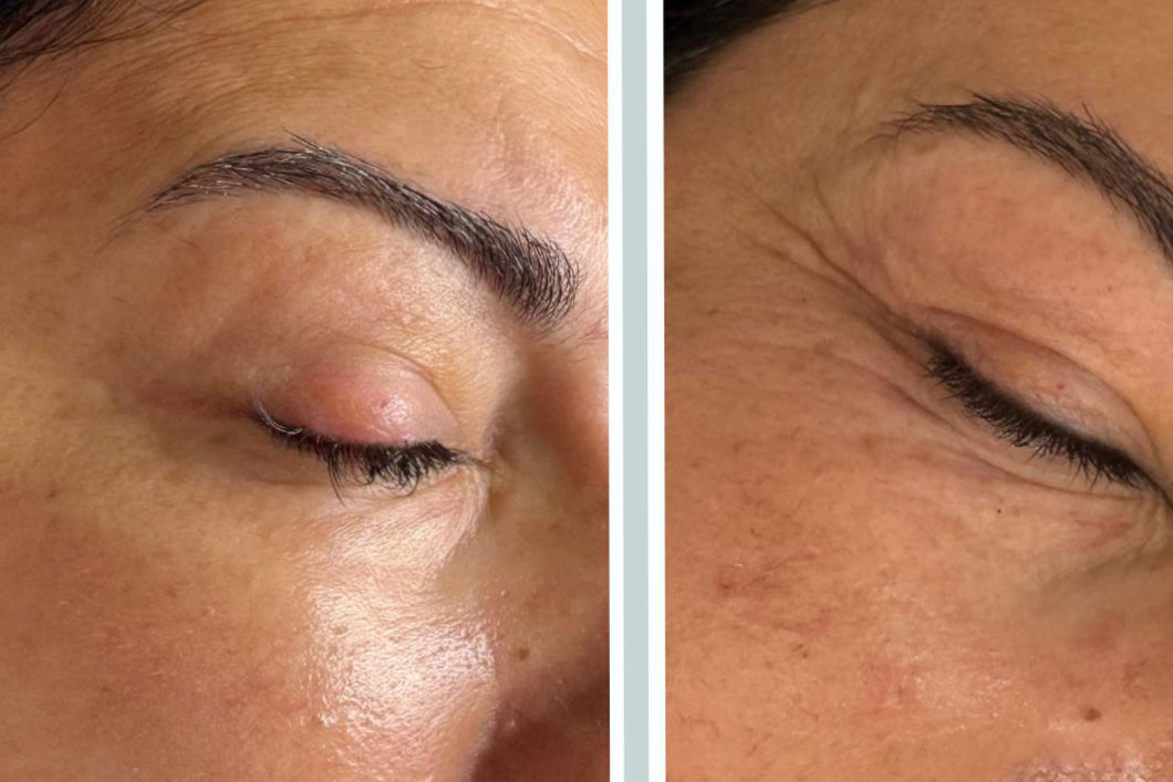 Servicios 4 facial